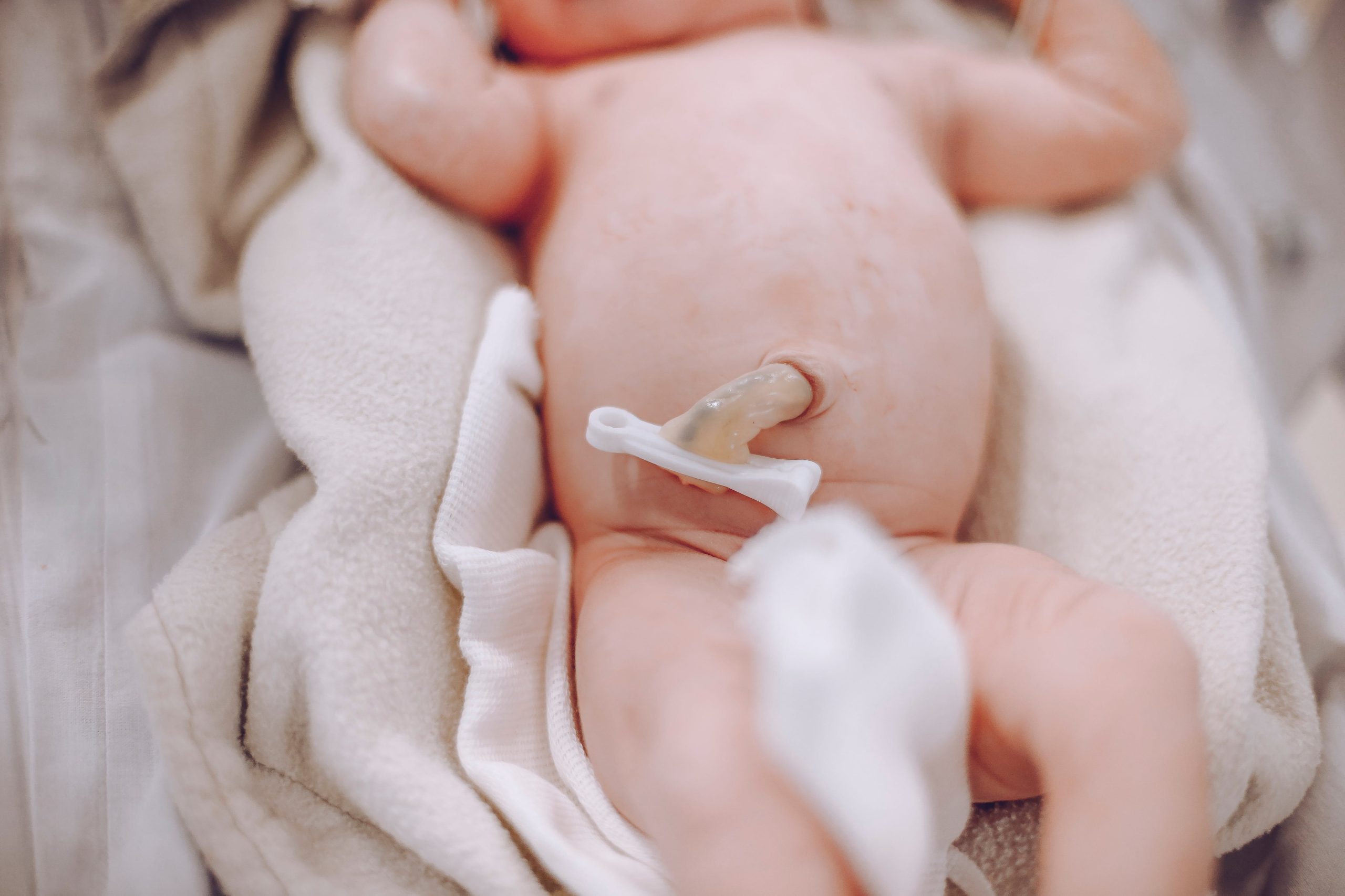 Higiene del cordón umbilical del recién nacido